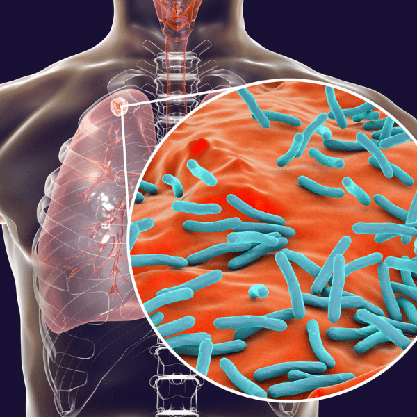 Tuberculosis (TB) testing for employee screening